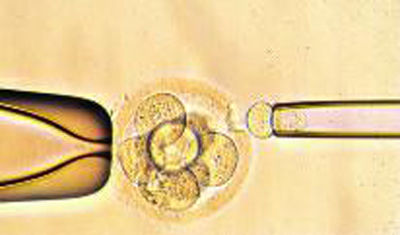Fig.01